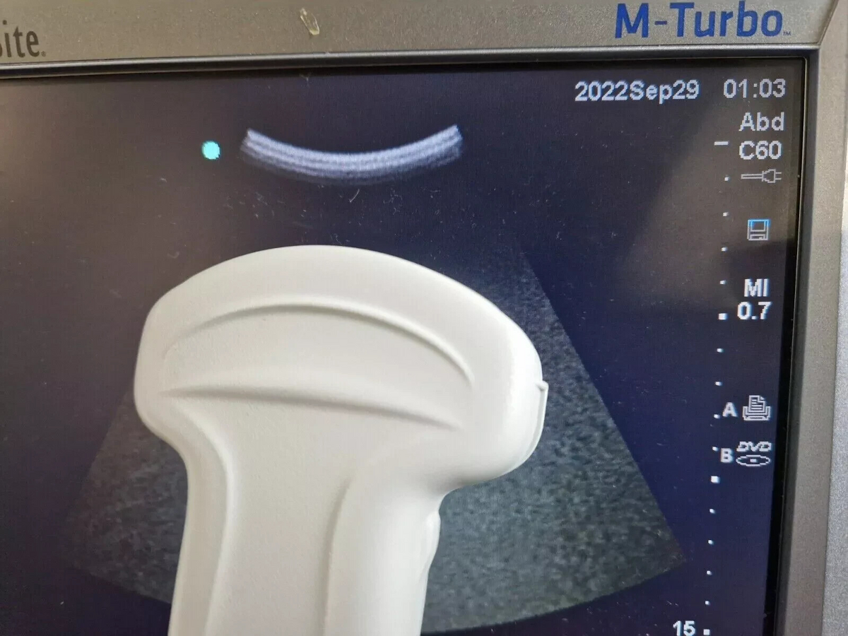 sonosite C60x 5 2 MHz ultrasound convex transducer probe ref P07680 15 M turbo1