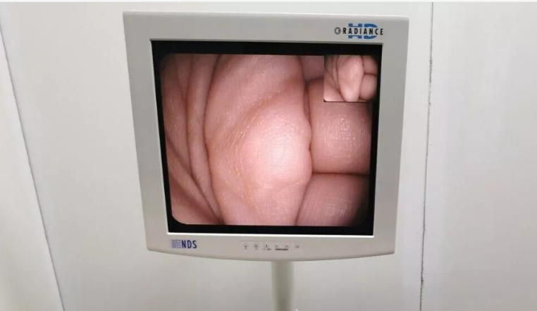 pentax EC 3470FK colonoscope video endoscope kolonoskop endoscopia3