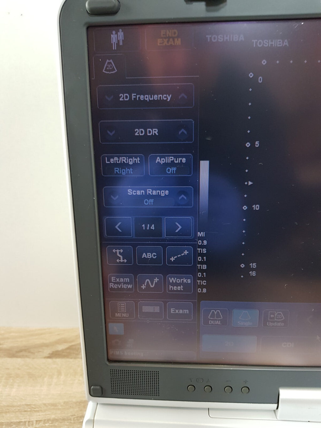 toshiba viamo SSA 640A SSA 640 ultrasound with PVT 375ST convex transducer probe11