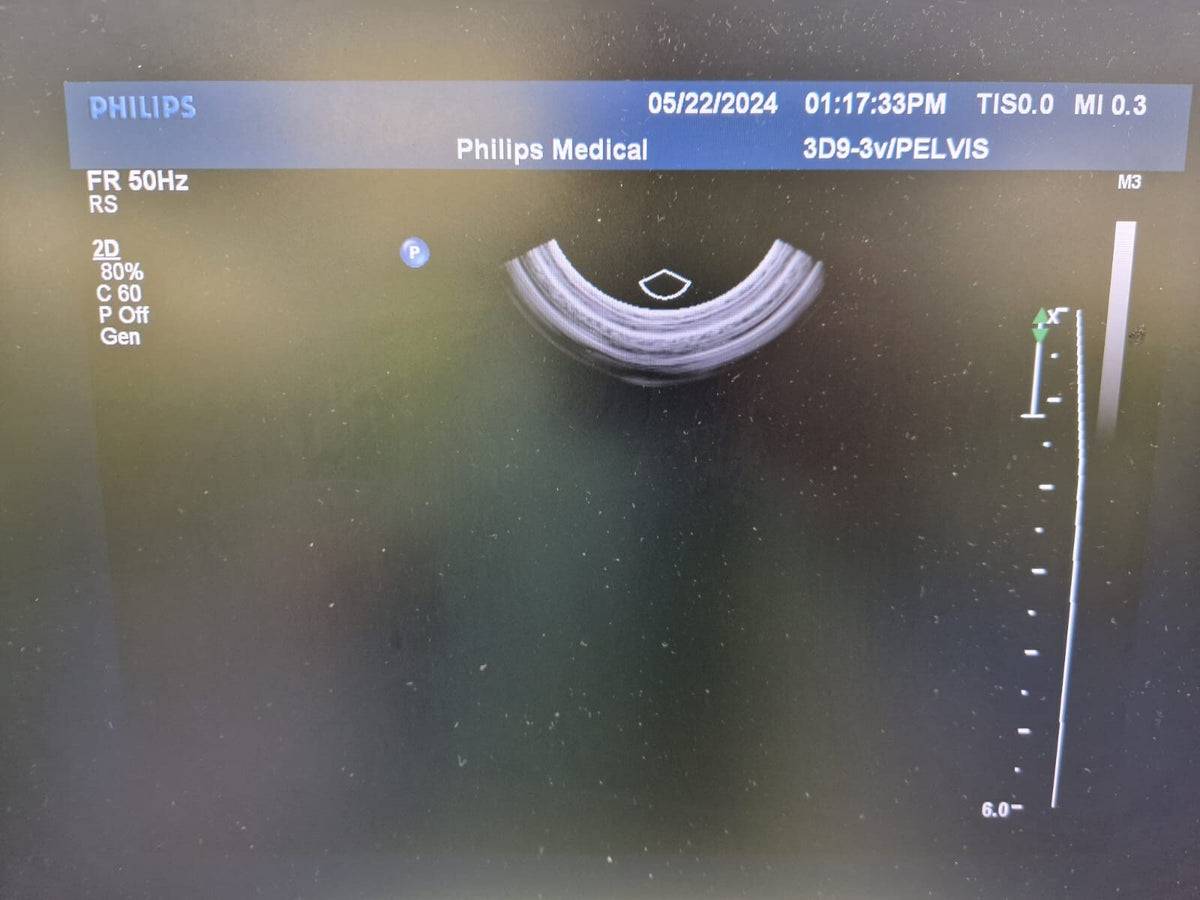 philips 3D9 3V ultrasound probe TV curved array transducer ultraschall sonde1