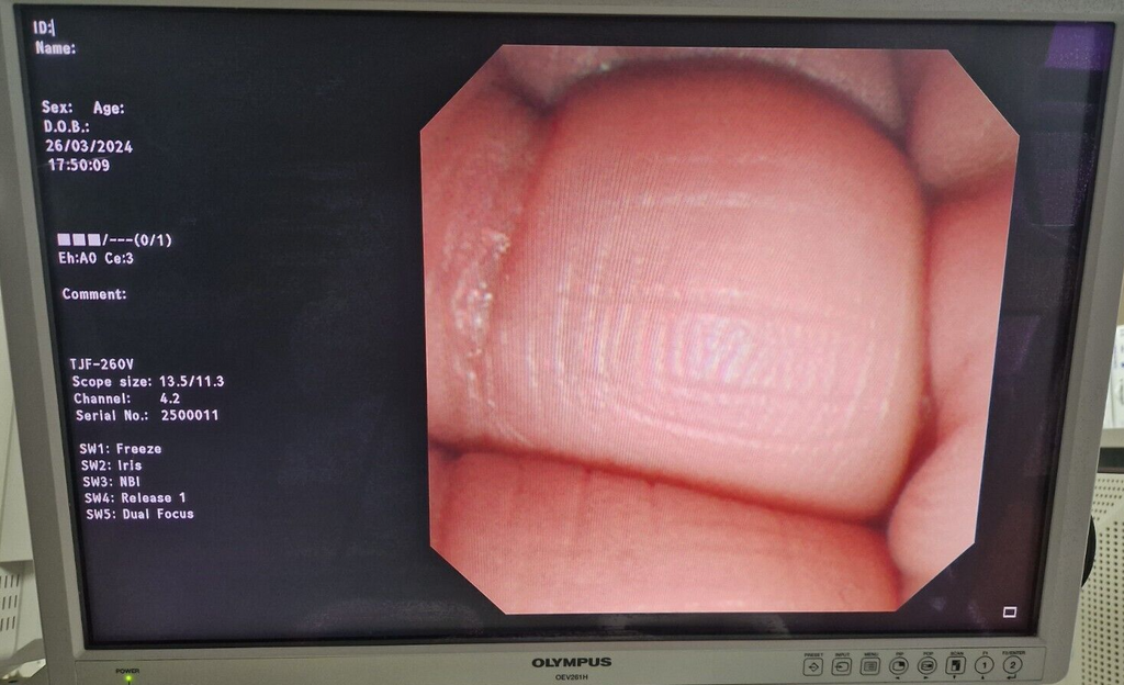 olympus TJF 260V ERCP duedenoscope video endoscope endoscope endoscopia2