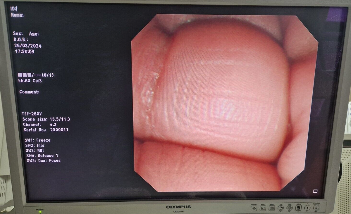 olympus TJF 260V ERCP duedenoscope video endoscope endoscope endoscopia2