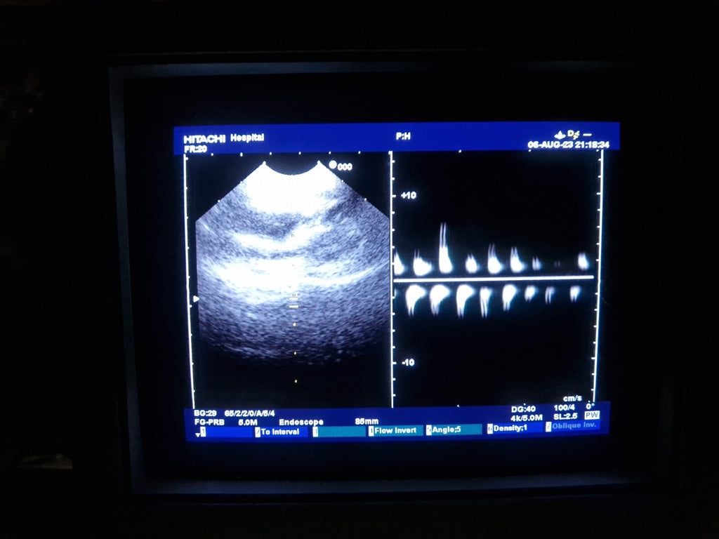 hitachi ultrasound TEE probe transducer 7.5 MHz EBUS pentax FG34UX gastroscope16