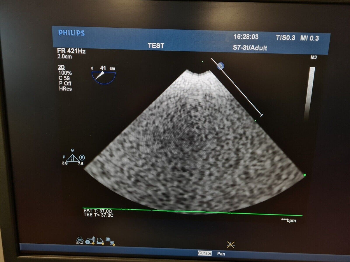philips S7 3t ultrasound TEE transducer probe transductor 변환기 transdutor1