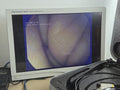 Pentax EG 3270UK linear convex array ultrasound video gastroscope EBUS + 2 valve0