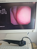 olympus CYF V video endoscope cystoscope visera v endoskop0