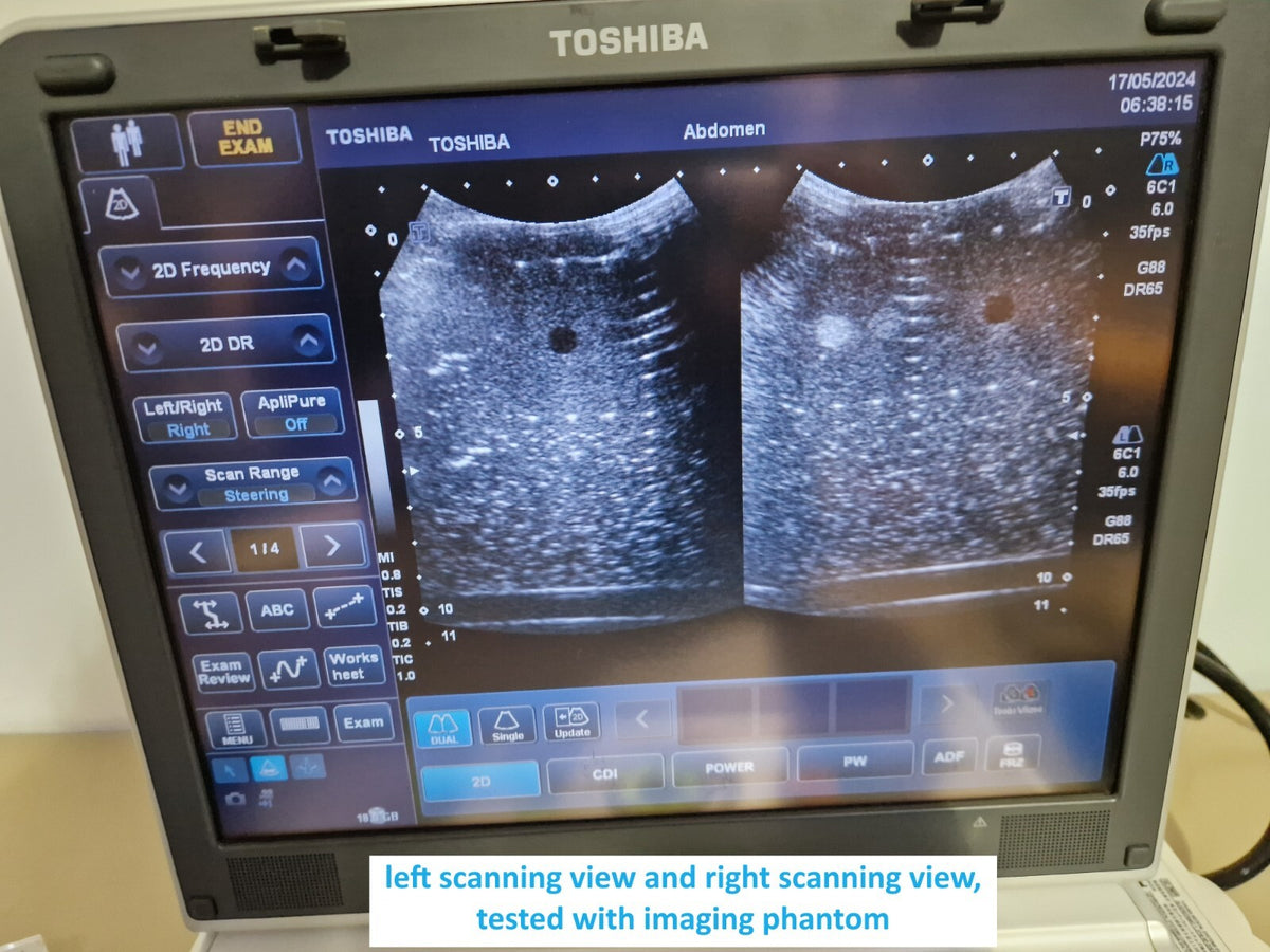 toshiba viamo SSA 640A SSA 640 ultrasound with PVT 375ST convex transducer probe17