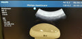 philips V6 2 convex 4D ultrasound probe transducer ultraschallsonden transductor0