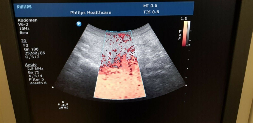 philips V6 2 convex 4D ultrasound probe transducer ultraschallsonden transductor2