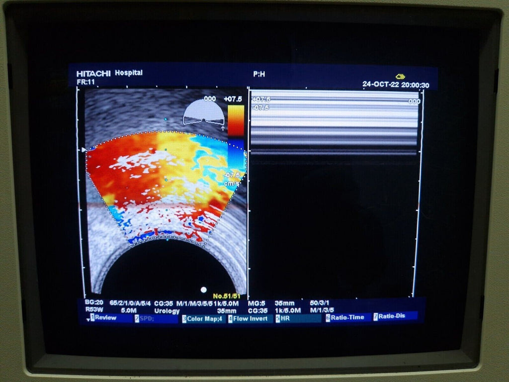 hitachi EUP 331 6.5 MHz TV ultrasound probe transducer ultrasonido transductor4