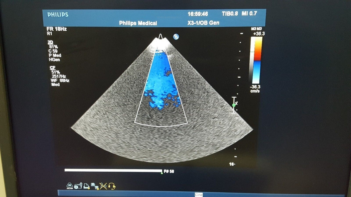 philips X3 1 ultrasound probe transducer ultraschallsonde transductor 변환기2