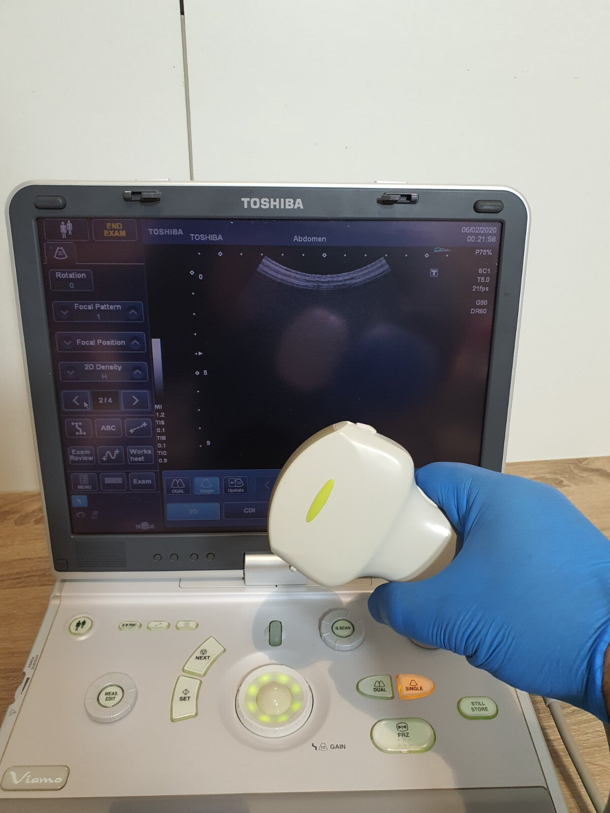 toshiba viamo SSA 640A SSA 640 ultrasound with PVT 375ST convex transducer probe7
