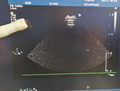 philips S12 4 ultrasound transducer probe S12 4 transdutor transductor 변환기0