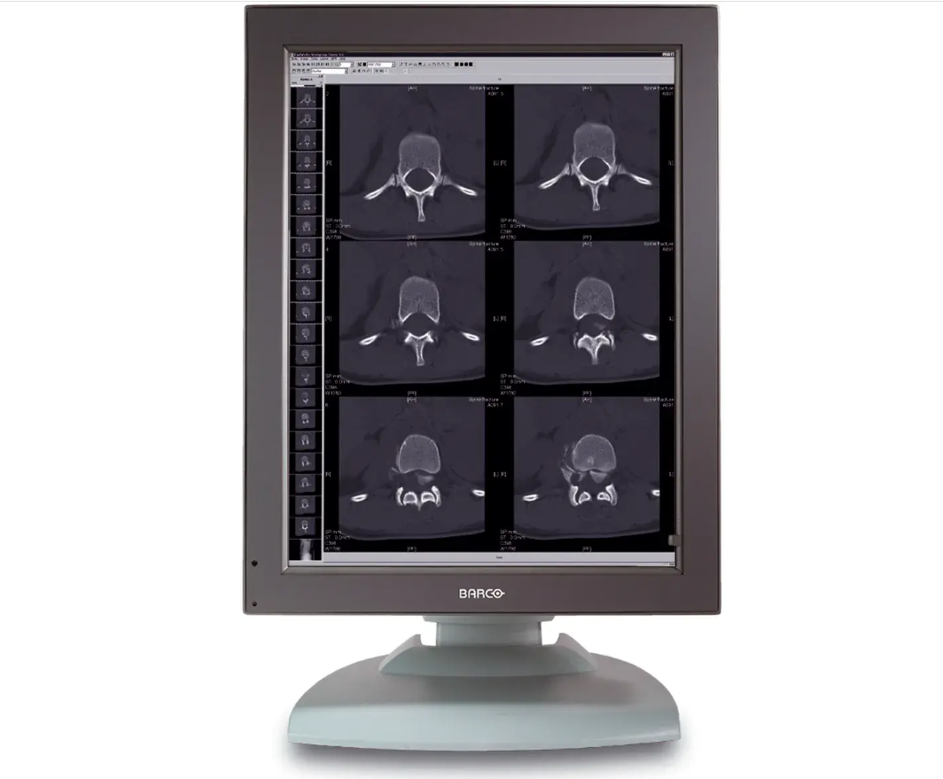 barco MFGD 2320 2MP  21" grayscale radiology display monitor K9300270A0