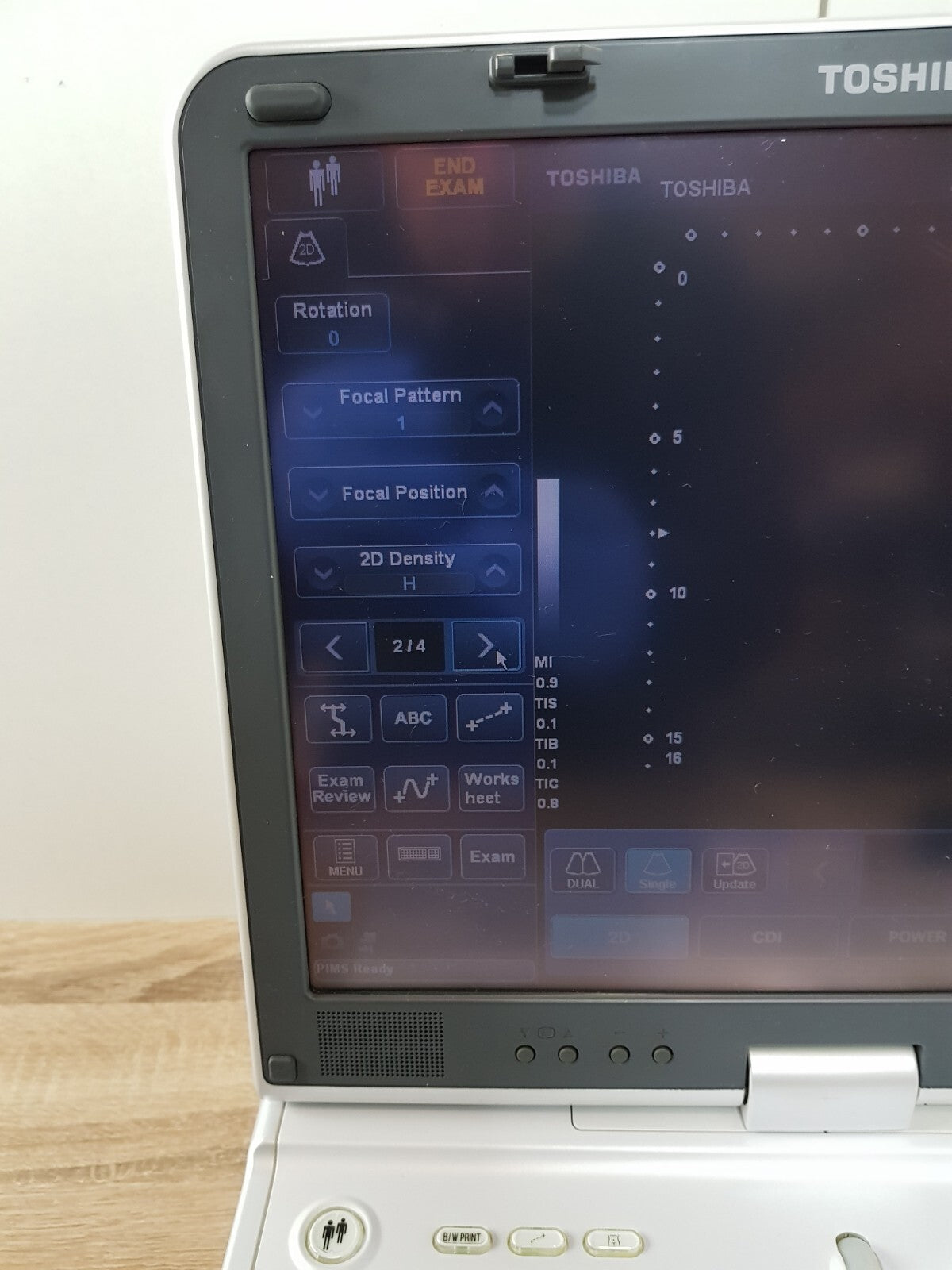 toshiba viamo SSA 640A SSA 640 ultrasound with PVT 375ST convex transducer probe13