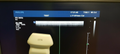 philips L17 5 linear ultrasound probe transducer 38mm transductor ultraschall0