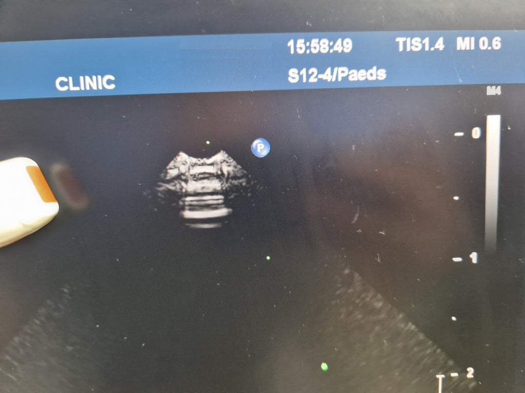philips S12 4 ultrasound transducer probe S12 4 transdutor transductor 변환기12