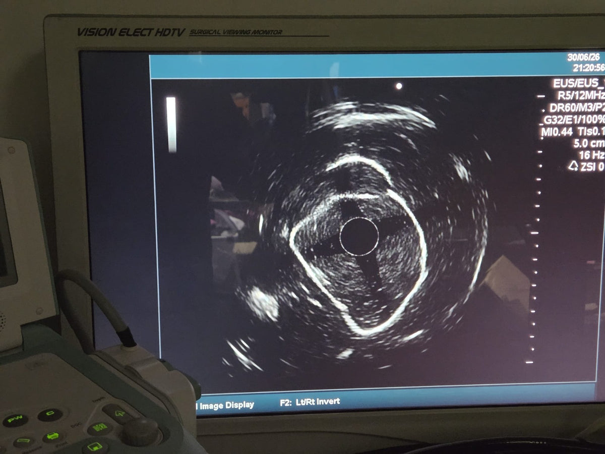 Fujinon Fujifilm Sonart SU 8000 endoscopic ultrasound processor with keyboard23