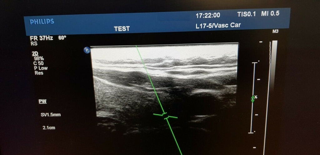 philips L17 5 linear ultrasound probe transducer 38mm transductor ultraschall1