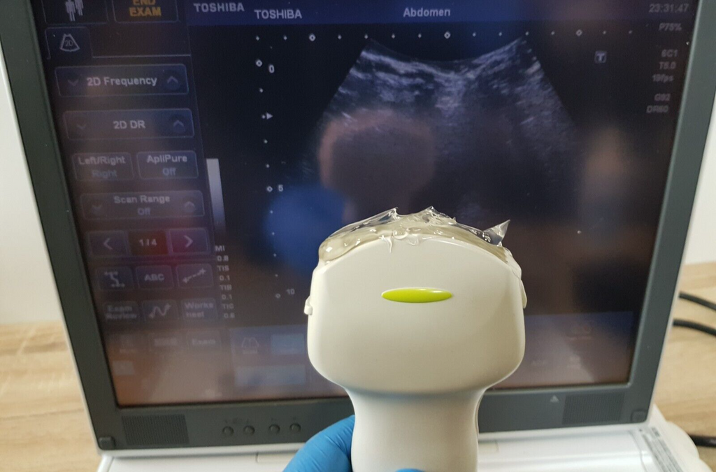 toshiba viamo SSA 640A SSA 640 ultrasound with PVT 375ST convex transducer probe16