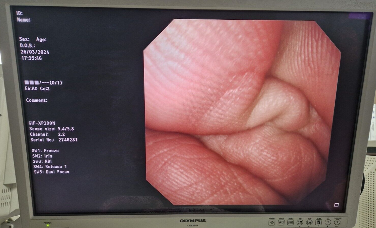 olympus GIF XP290N evis lucera elite video gastroscope endoscope endoscopia2