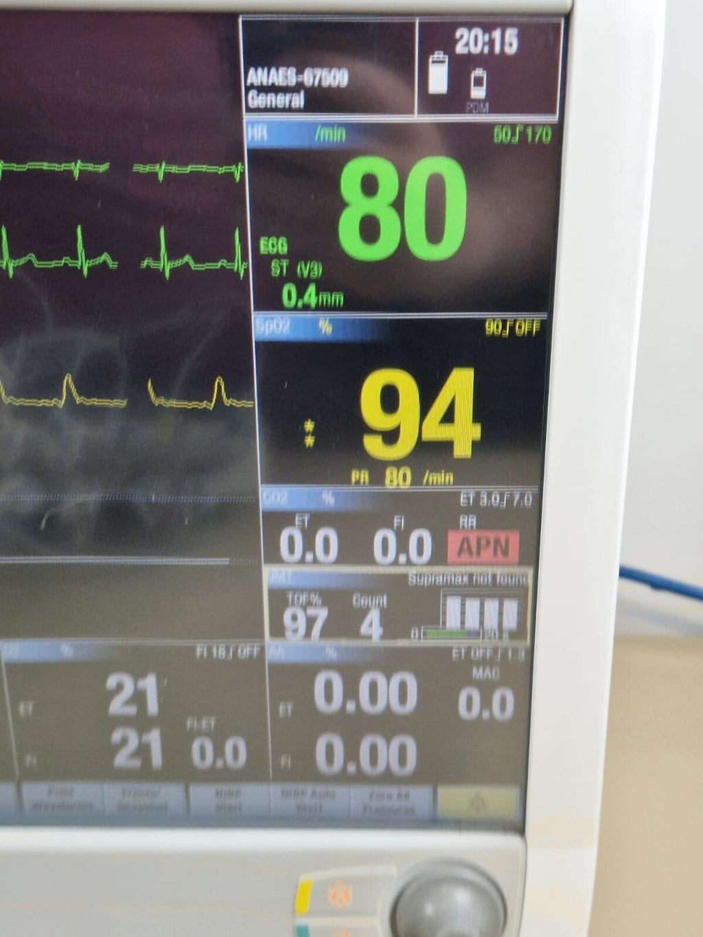 ge carescape B650 anaesthesia patient monitor with E sCAiO gas   E NMT module GE4