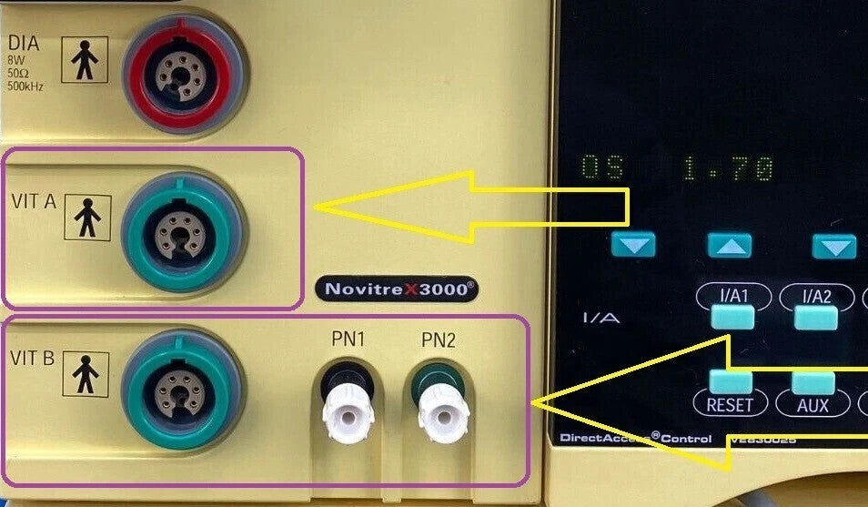 oertli vitrectomy phaco handpiece with green ring vitrectomía por facoemulsifica1
