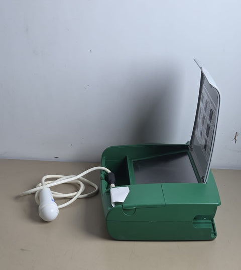 Bard Bardscan IIs Portable Ultrasound Bladder Scanner with Probe and Printer