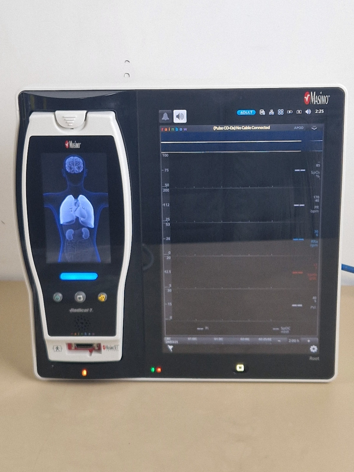 Masimo Root RDS-7 with docked Radical-7 rainbow SET monitor and patient cables