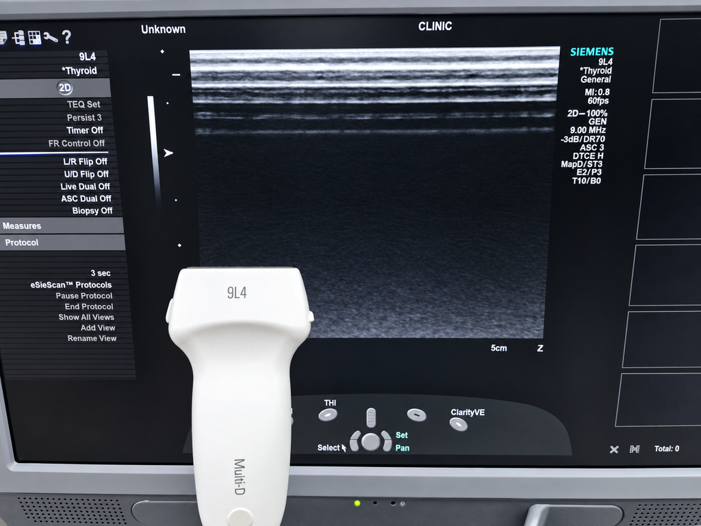Siemens ACUSON 9L4 linear probe connected to ultrasound system showing test scan