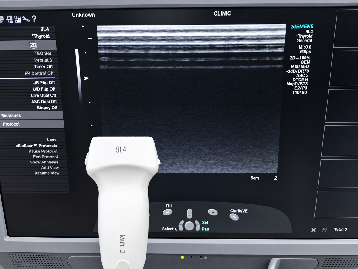 Siemens ACUSON 9L4 linear probe connected to ultrasound system showing test scan